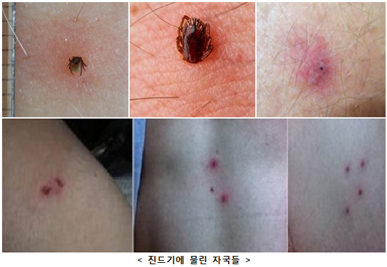 ▲ 봄철 야생진드기 주의보…가을보다 더 위험